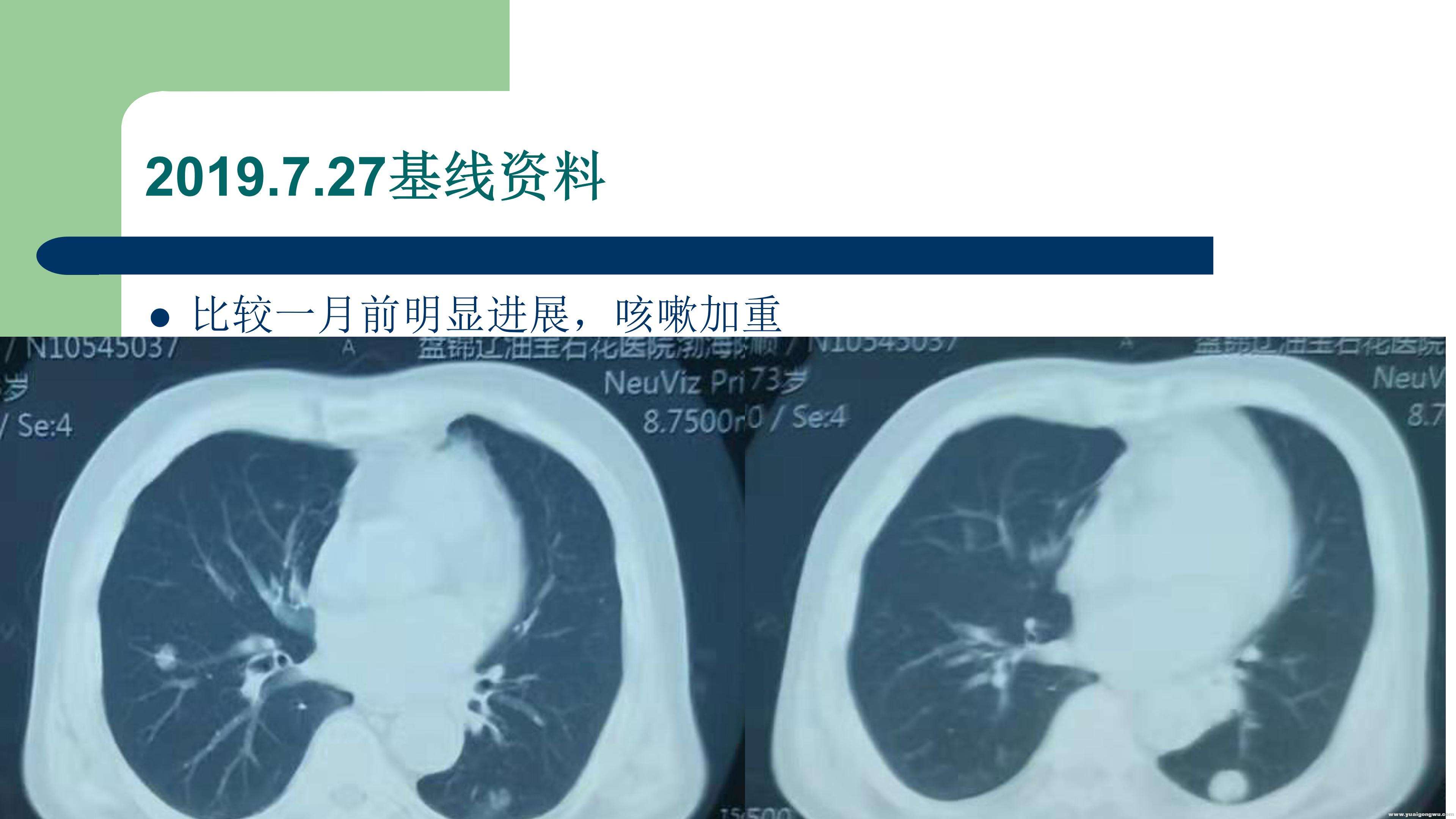 PD1病例分享_08.jpg