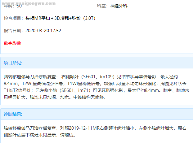 脑部核磁报告